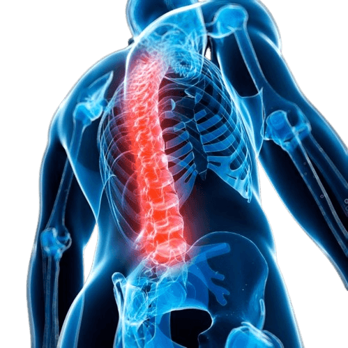 Ankylosing spondylitis