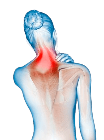 Fibromyalgia