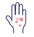 Skin rashes icon