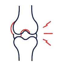 Joint swelling icon
