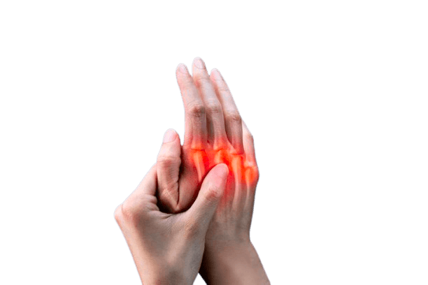 Illustration of rheumatoid arthritis affecting the hand joints