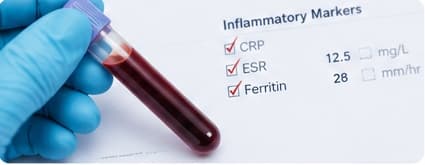 Inflammatory marker blood test and lab report